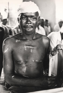 Moutse resident, with injuries on body and head, attacked vigilantes on 1 January 1986