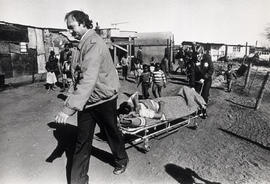 A woman, injured in July, 1987, during the violent removal of squatters in Chicken Farm, Soweto, ...