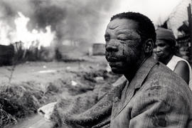 An injured KTC man watches as his shack burns during renewed violence in the squatter camp