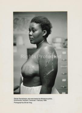 Rahab Ramathetse, who was beaten by Motetema police, Groblersdal, Northern Transvaal